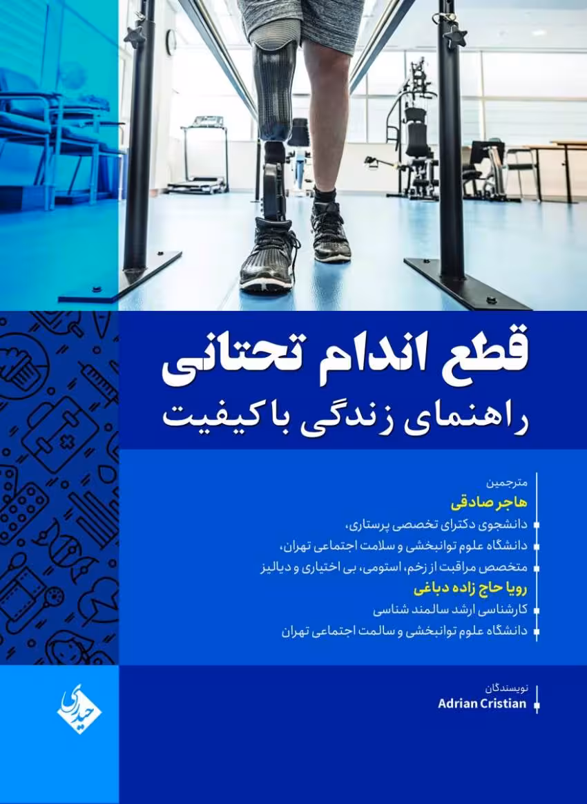 قطع اندام تحتانی راهنمای زندگی با کیفیت