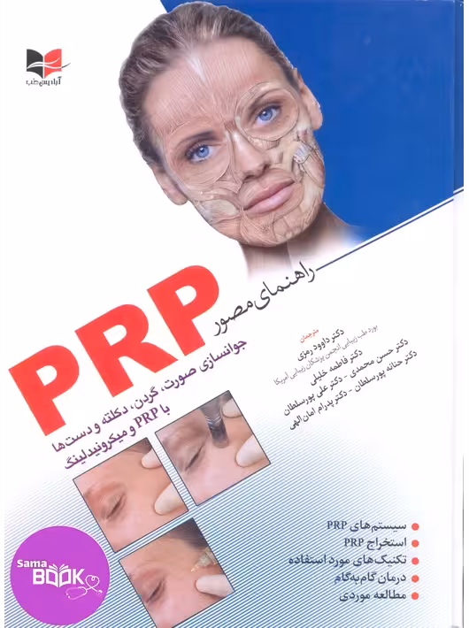 راهنمای مصور PRP دکتر داوود رمزی