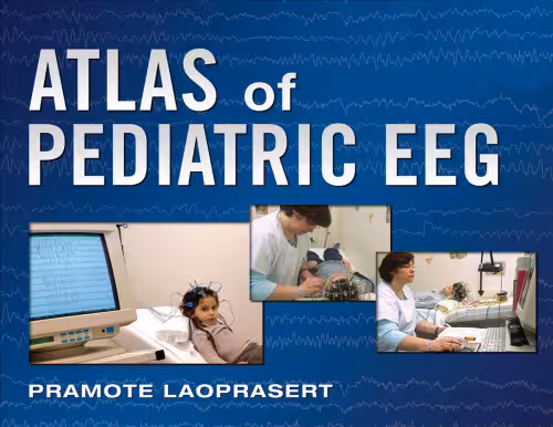 خرید و دانلود نسخه کامل کتاب Atlas of Pediatric EEG (Atlas Series)