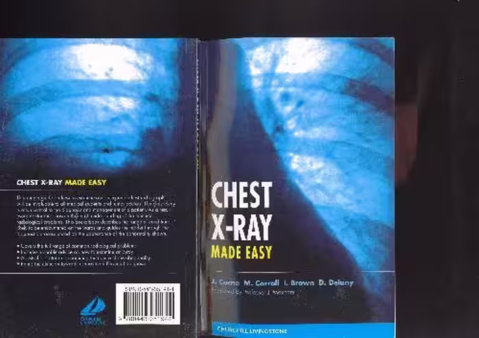 خرید و دانلود نسخه کامل کتاب Chest X-Ray Made Easy