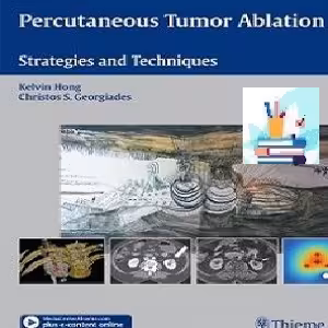 Percutaneous Tumor Ablation TRUE PDF price 1€