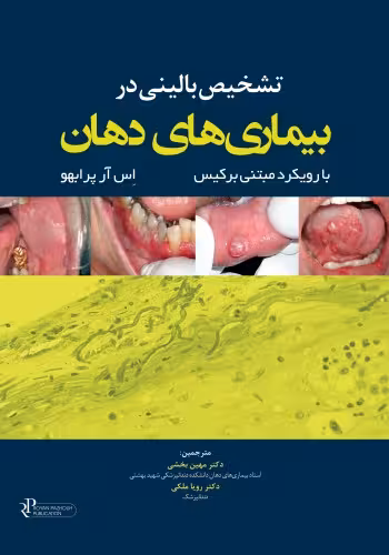 تشخیص بالینی در بیماریهای دهان با رویکرد مبتنی برکیس