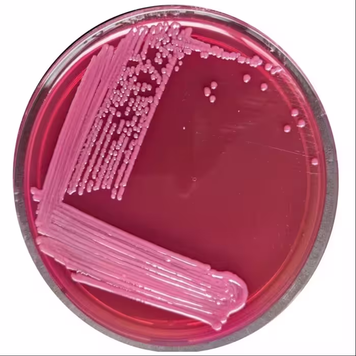 محیط کشت اماده مکانکی اگار MacConkey Agar