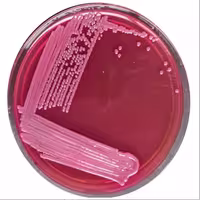 محیط کشت اماده مکانکی اگار MacConkey Agar