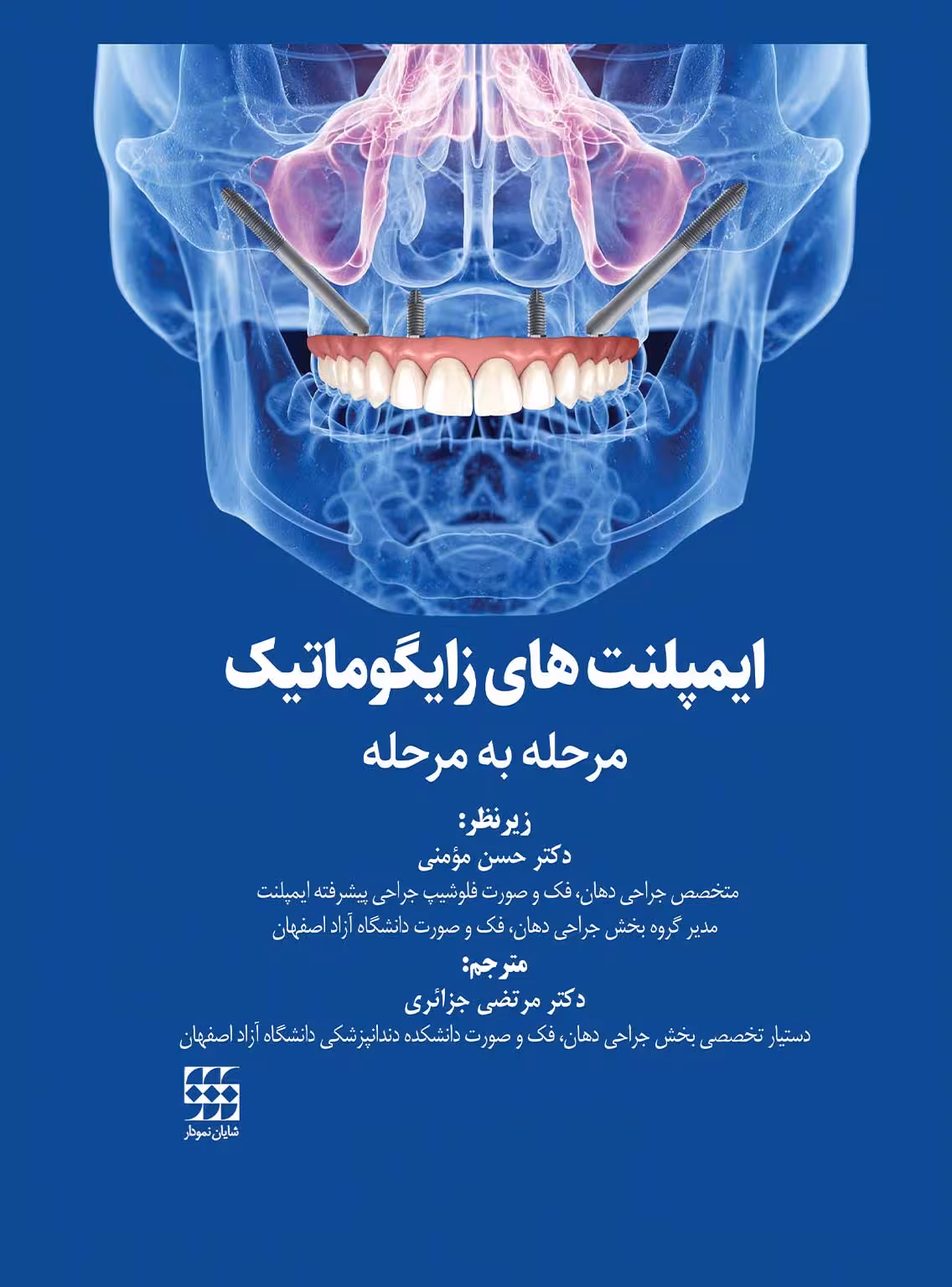 کتاب ایمپلنت های زایگوماتیک (مرحله به مرحله)