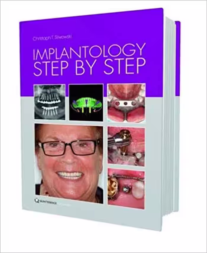 خرید و دانلود نسخه کامل کتاب Implantology Step by Step 2nd Edition