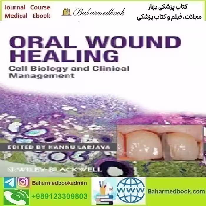 Oral Wound Healing Cell Biology and Clinical Management 201