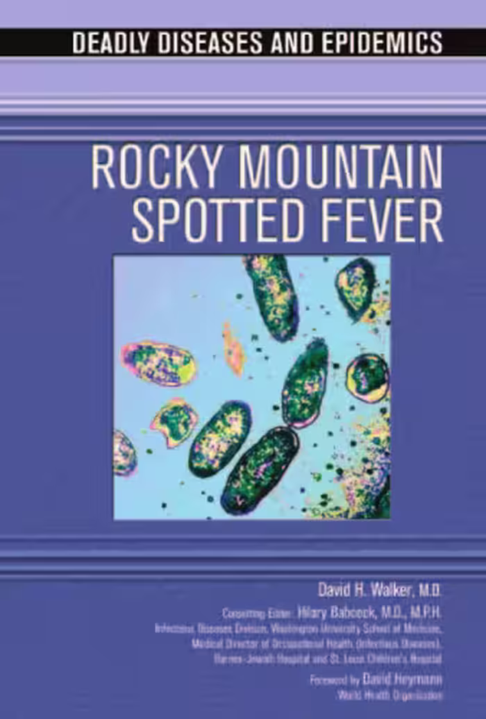 خرید و دانلود نسخه کامل کتاب Rocky Mountain Spotted Fever (Deadly Diseases and Epidemics)