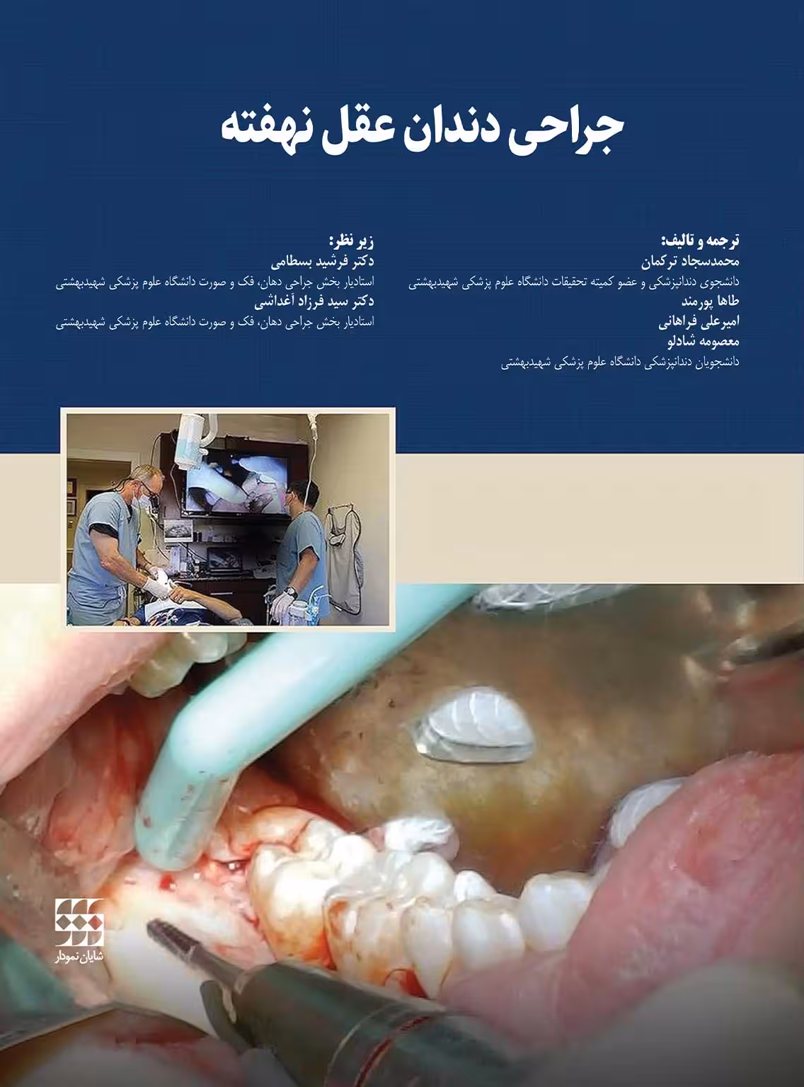 جراحی دندان عقل نهفته شایان نمودار