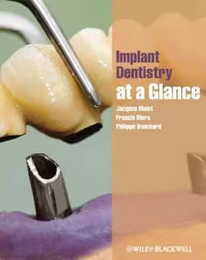 [PDF] دانلود کتاب Implant Dentistry At-A-Glance, 2012