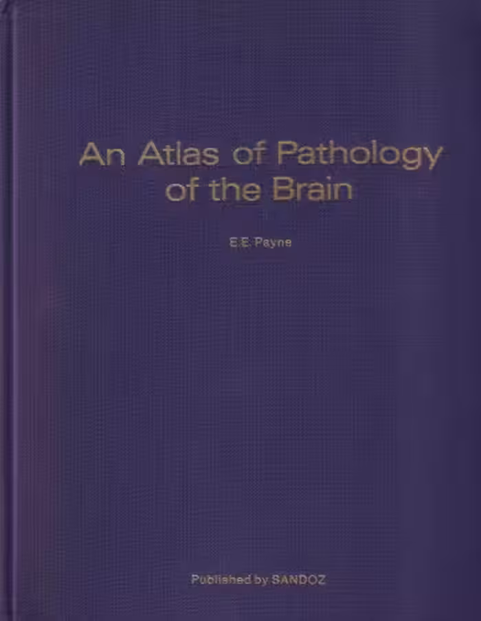 خرید و دانلود نسخه کامل کتاب An Atlas of Pathology of the Brain