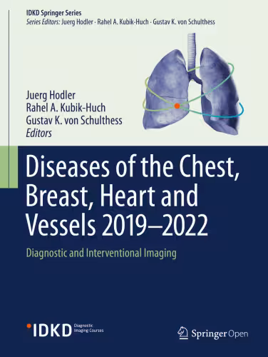 خرید و دانلود نسخه کامل کتاب Diseases of the Chest, Breast, Heart and Vessels 2019-2022: Diagnostic and Interventional Imaging