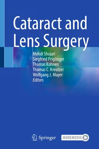 خرید و دانلود نسخه کامل کتاب Cataract and Lens Surgery