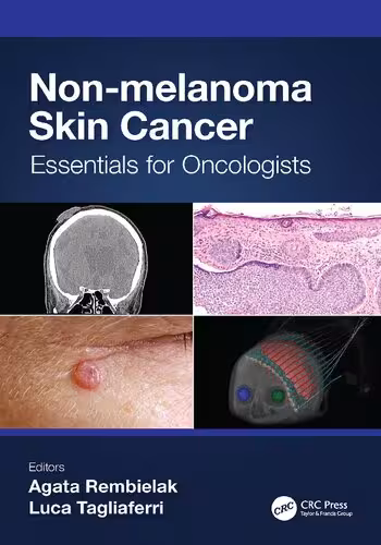 خرید و دانلود نسخه کامل کتاب Non-melanoma Skin Cancer: Essentials for Oncologists