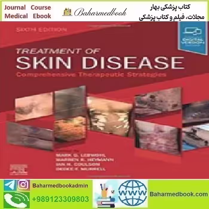 Treatment of Skin Disease Comprehensive Therapeutic Strategie