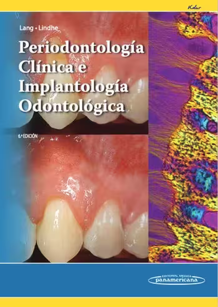 خرید و دانلود نسخه کامل کتاب Periodontología Clínica e Implantología Odontológica TOMO 1 y 2 by KADUR