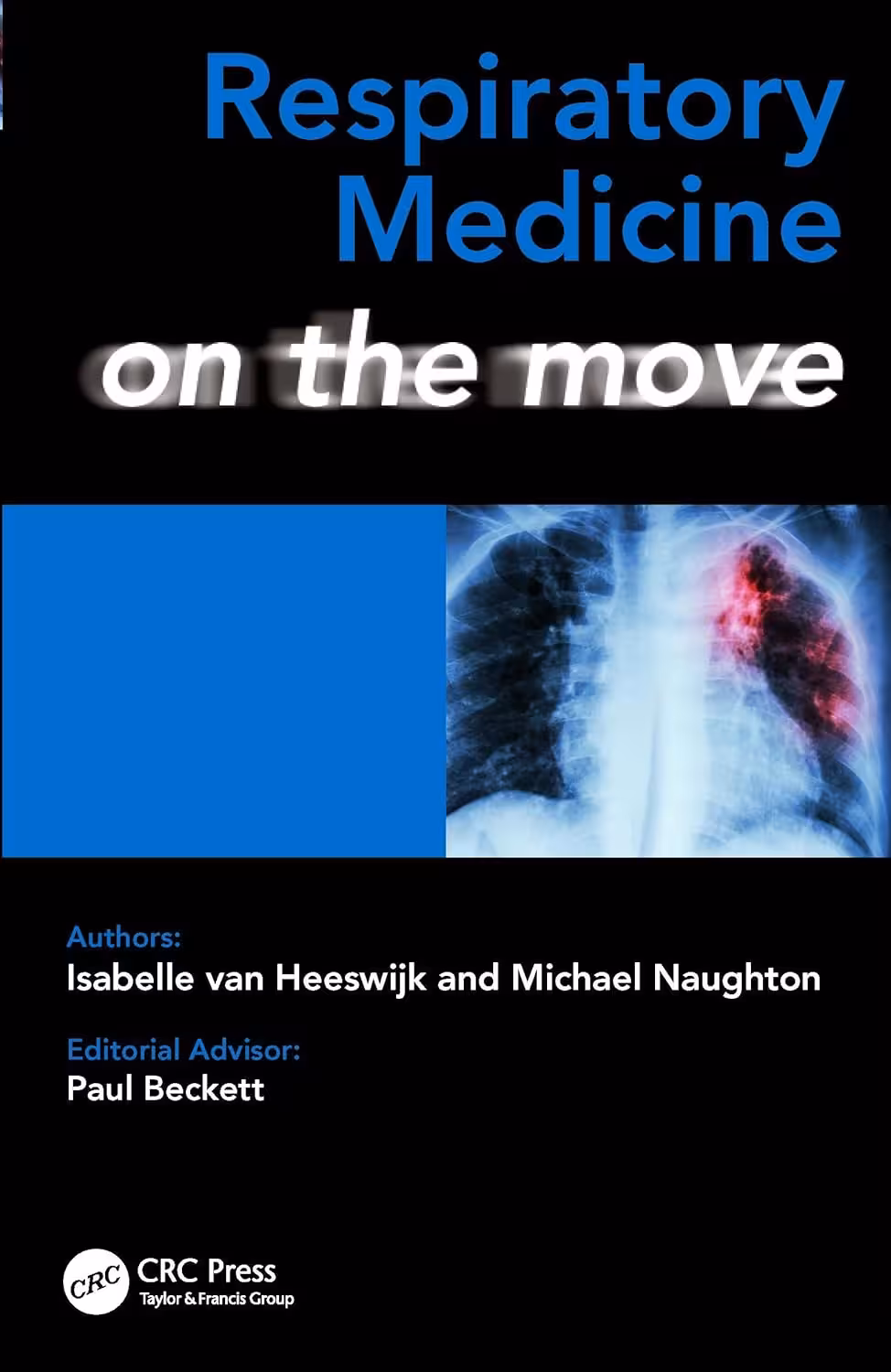 خرید و دانلود نسخه کامل کتاب Respiratory Medicine on the Move
