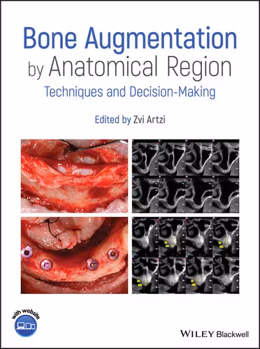 خرید و دانلود نسخه کامل کتاب Bone Augmentation by Anatomical Region: Techniques and Decision-Making