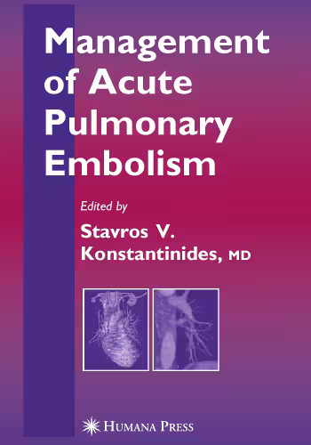 خرید و دانلود نسخه کامل کتاب Management of Acute Pulmonary Embolism (Contemporary Cardiology)