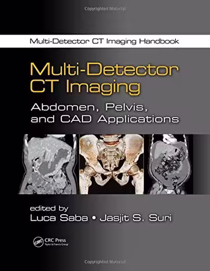 خرید و دانلود نسخه کامل کتاب Multi-Detector CT Imaging Handbook, Two Volume Set