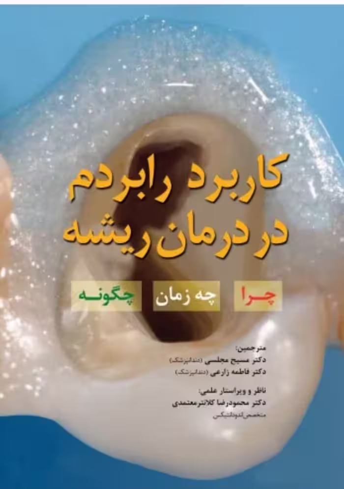 کاربرد رابردم در درمان ریشه چرا - چه زمان - چگونه