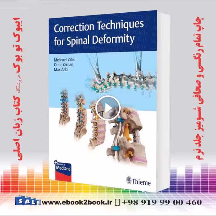 Correction Techniques for Spinal Deformity