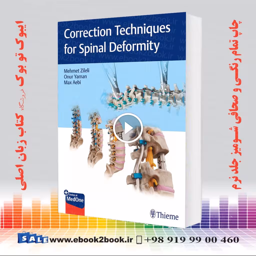 Correction Techniques for Spinal Deformity
