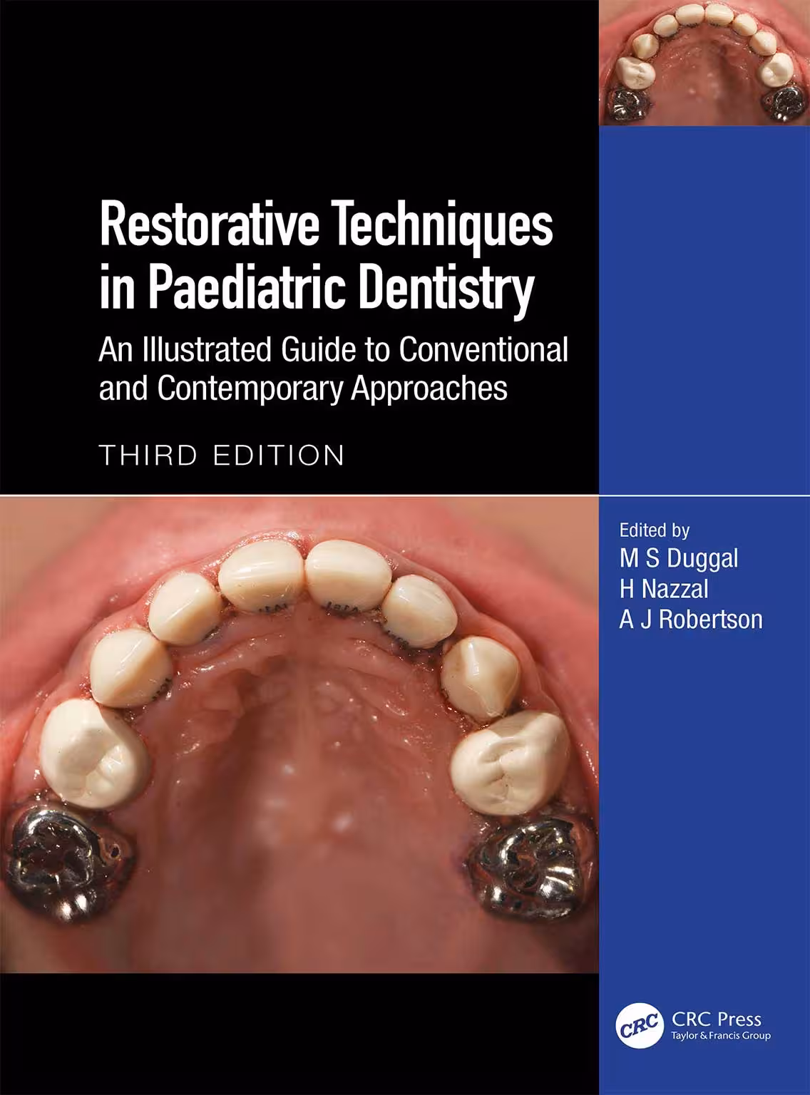 کتاب Restorative Techniques in Paediatric Dentistry 2024