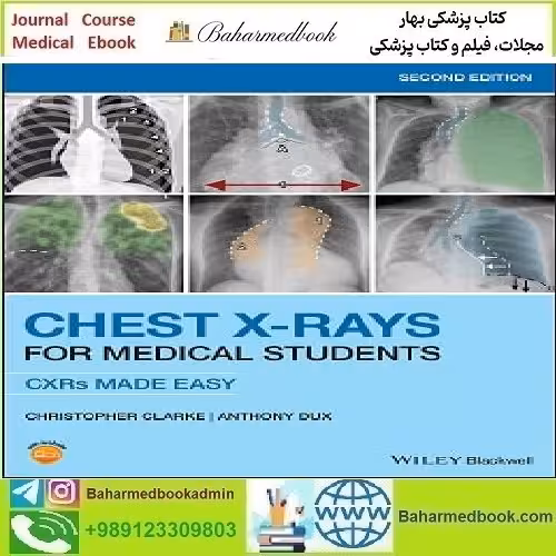 Chest X-Rays for Medical Students 2020 TRUE PDF price 1€ - کتاب پزشکی بهار