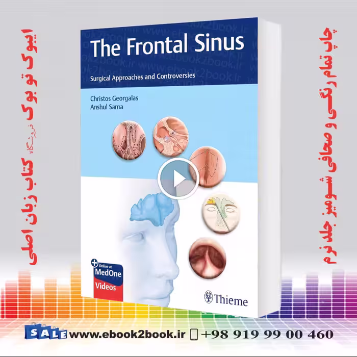 The Frontal Sinus: Surgical Approaches and Controversies