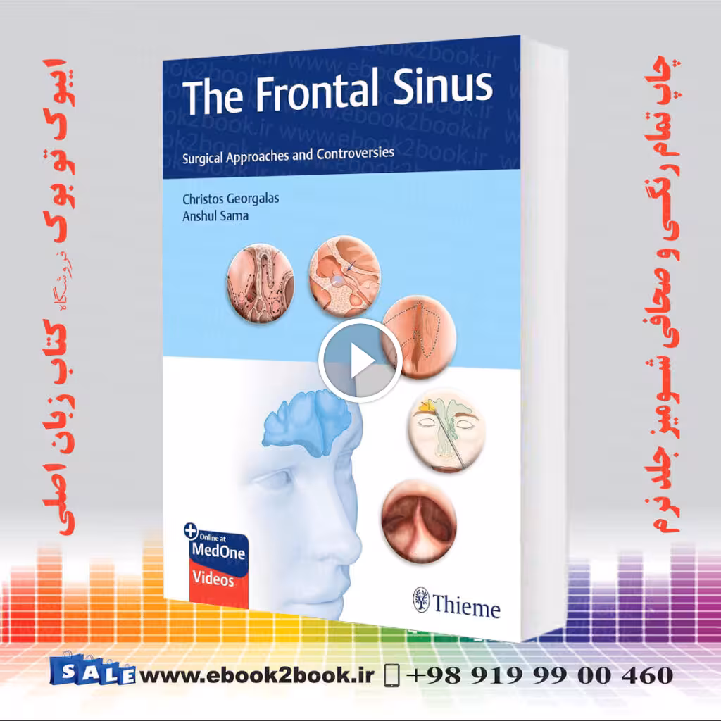 The Frontal Sinus: Surgical Approaches and Controversies