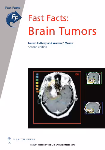 خرید و دانلود نسخه کامل کتاب Brain Tumors