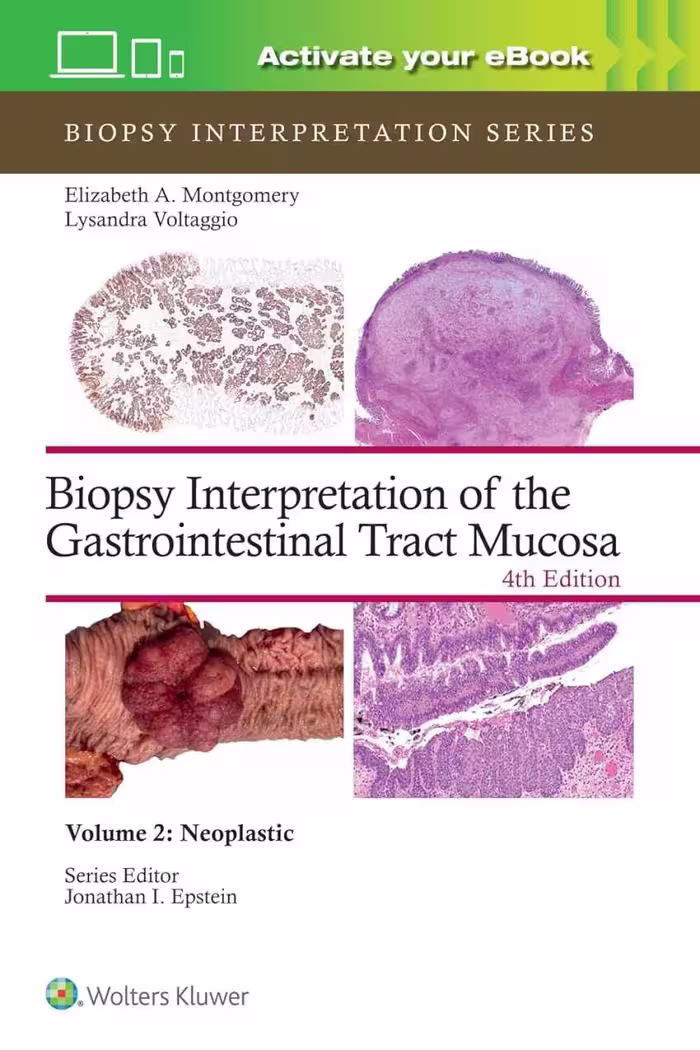 کتاب Biopsy Interpretation of the Gastrointestinal Tract Mucosa: Neoplastic, 2024 زبان اصلی