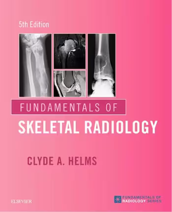 خرید و دانلود نسخه کامل کتاب Fundamentals of Skeletal Radiology