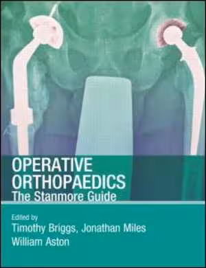 [PDF] دانلود کتاب Operative Orthopaedics - The Stanmore Guide, 2009