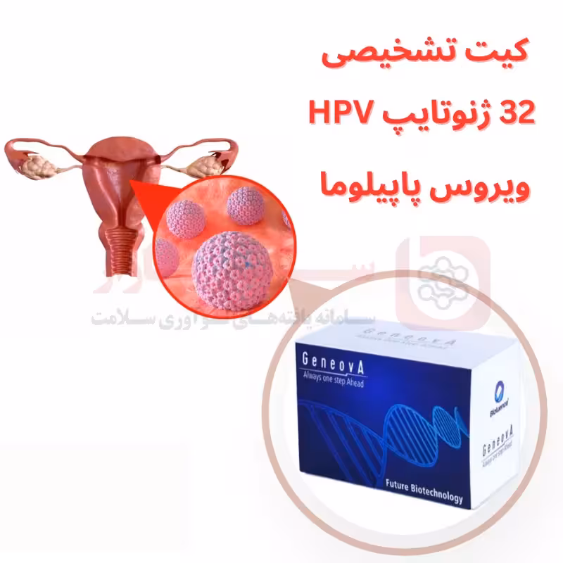 کیت تشخیص ویروس HPV به روش Taqman Real Time PCR