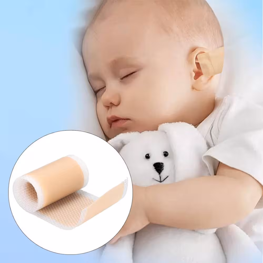 چسب فرم دهی و اصلاح گوش نوزاد