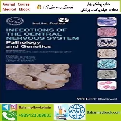 Infections of the Central Nervous System Pathology and Genetics