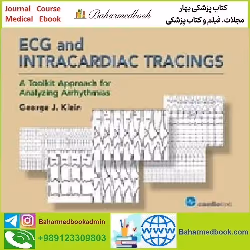 ECG and Intracardiac Tracings TRUE PDF price 1€ - کتاب پزشکی بهار