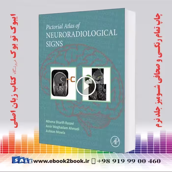 Pictorial Atlas of Neuroradiological Signs