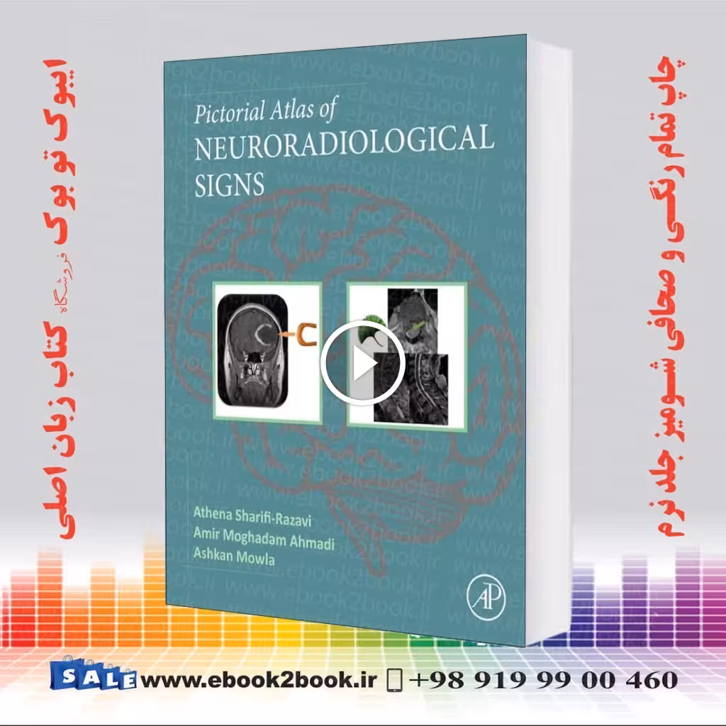 Pictorial Atlas of Neuroradiological Signs