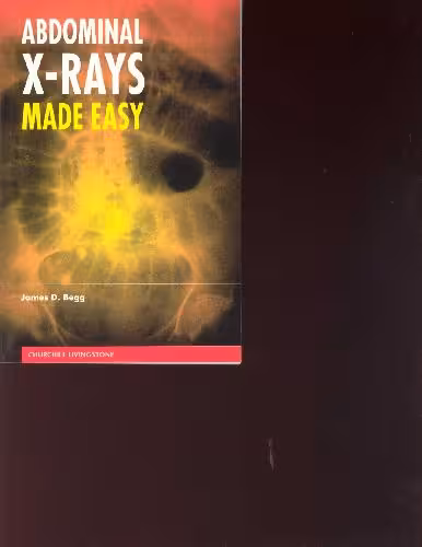 خرید و دانلود نسخه کامل کتاب ABDOMINAL X-RAYS MADE EASY