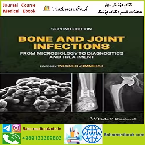 Bone and Joint Infections TRUE PDF price 1€ - کتاب پزشکی بهار