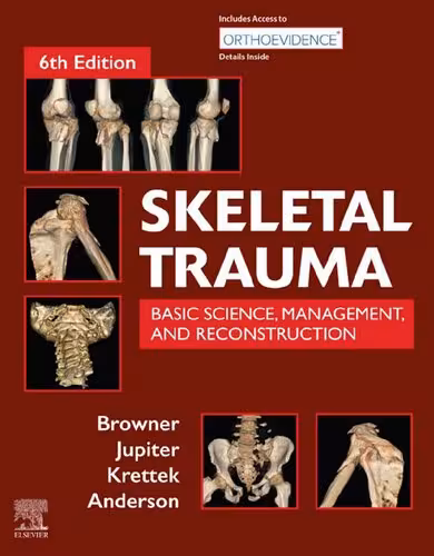 خرید و دانلود نسخه کامل کتاب Skeletal Trauma: Basic Science, Management, and Reconstruction, 2-Volume Set 6th Edition