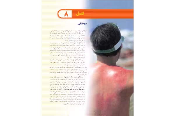 سوختگي 🔬 - کتابخانه مجازی واتیکان