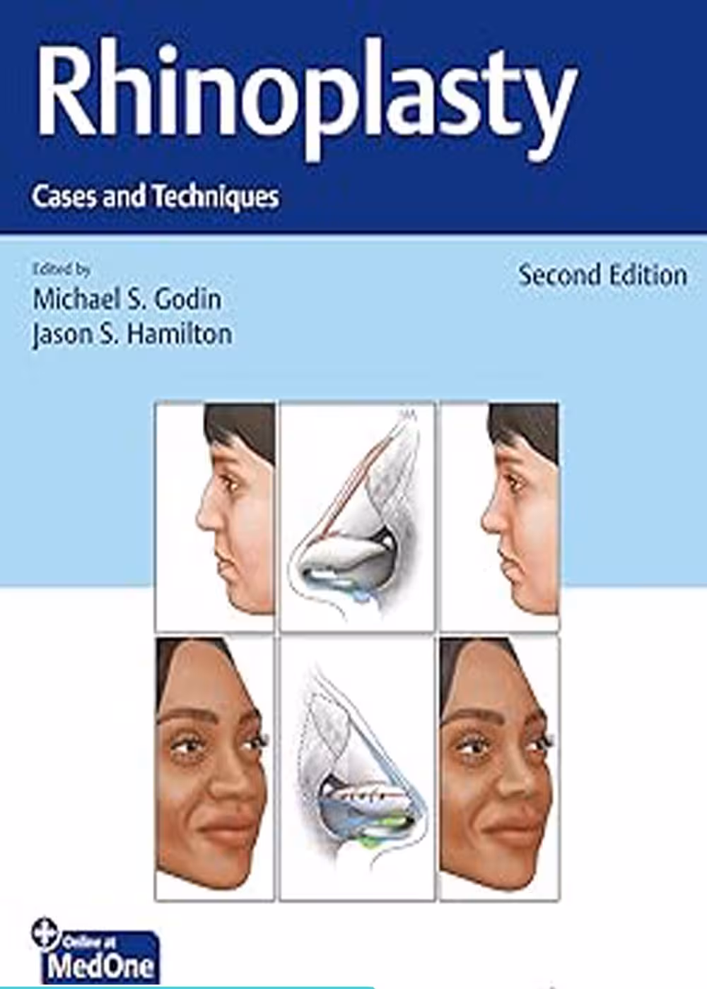 Rhinoplasty Cases and Techniques 2nd Edition رینوپلاستی موارد و تکنیک ها ویرایش دوم