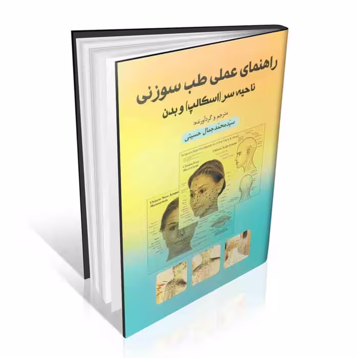 راهنمای عملی طب سوزنی ناحیه سر ( اسکالپ ) و بدن