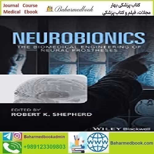 Neurobionics The Biomedical Engineering of Neural Prostheses