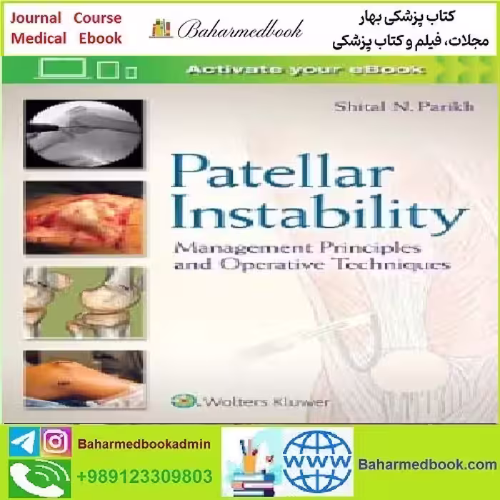 Patellar Instability Management Principles and Operative Techniq