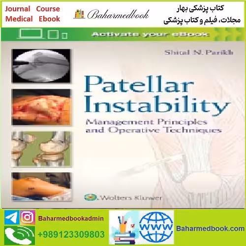 Patellar Instability Management Principles and Operative Techniq